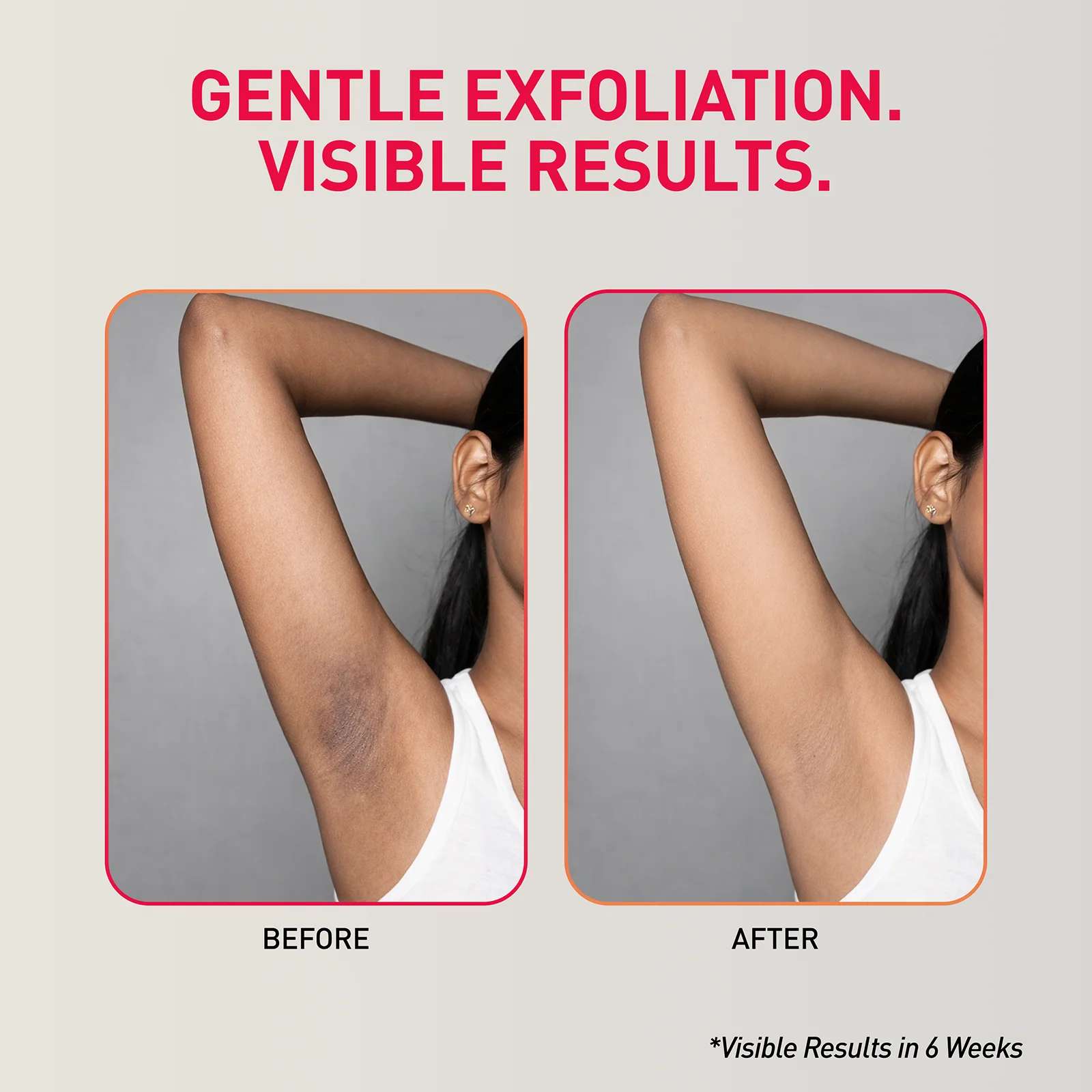 Depigmentation Underarm Mist - Image 5